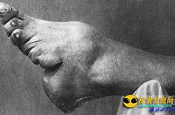 世界8大骇人恐怖习俗：中国两项上榜_灵异鬼话玛丽人