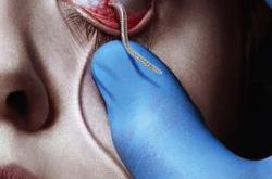 血族第一季MP4格式