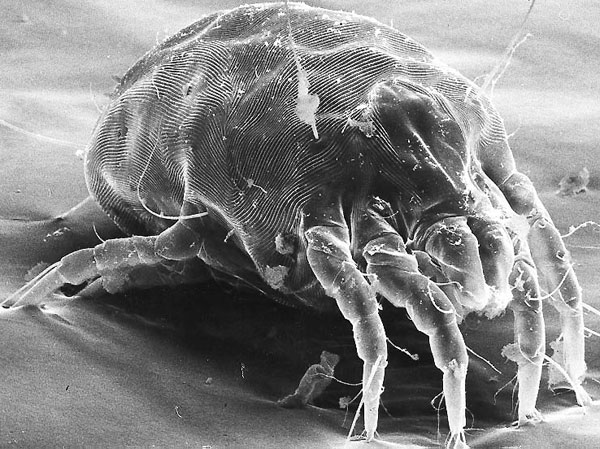 女孩睡觉半夜憋醒以为是中邪 医生回复:羽绒被螨虫作祟