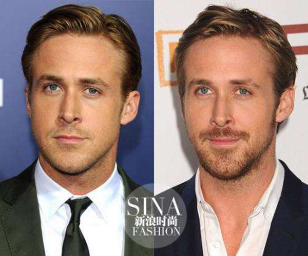 脸盲证是什么引起的