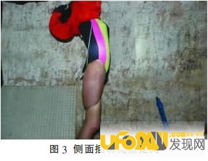 重庆红衣男孩事件最后的真相：匡志均大人物续命是真的吗